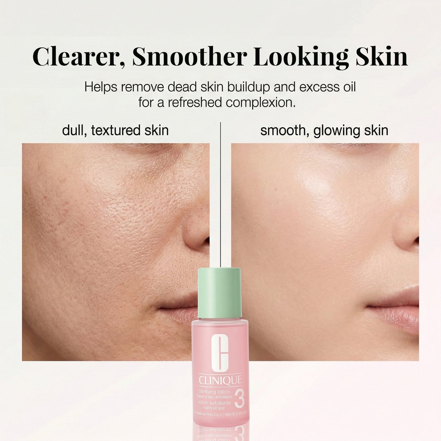 Clinique Clarifying Lotion 3 Exfoliating Toner for Combination Oily Skin - Travel Size Set (3 x 1 oz)