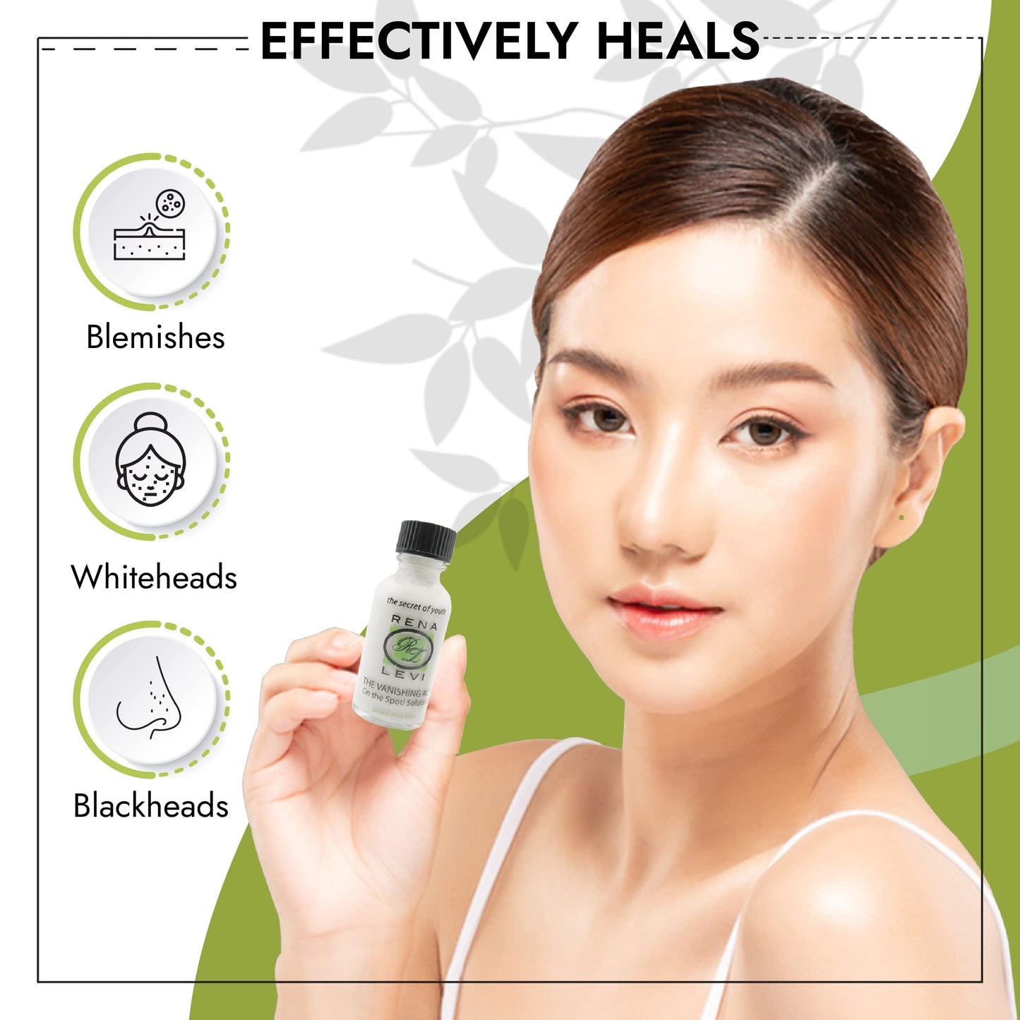 Rena Levi Acne Spot Treatment - One The Spot Acne Treatment For Face - Body Acne Treatment For Women - Acne Lotion For Face And Body - Dries Out Blemishes And Pores - Back Acne Treatment - 1oz