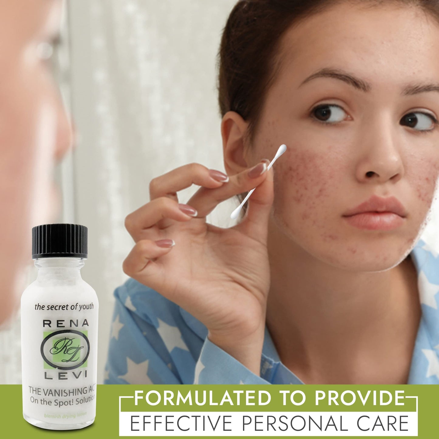 Rena Levi Acne Spot Treatment - One The Spot Acne Treatment For Face - Body Acne Treatment For Women - Acne Lotion For Face And Body - Dries Out Blemishes And Pores - Back Acne Treatment - 1oz