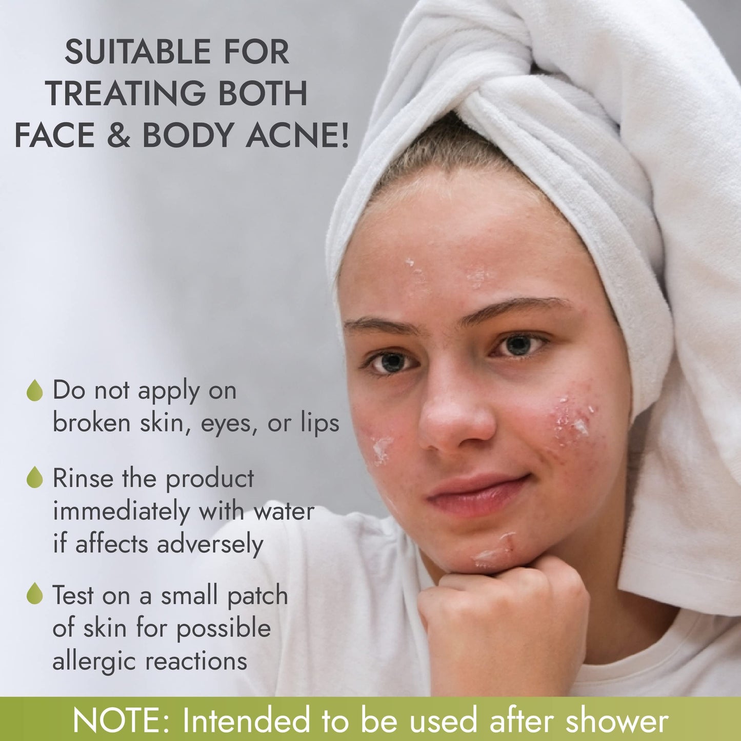 Rena Levi Acne Spot Pimple Drying Lotion – 1 oz Acne Treatment