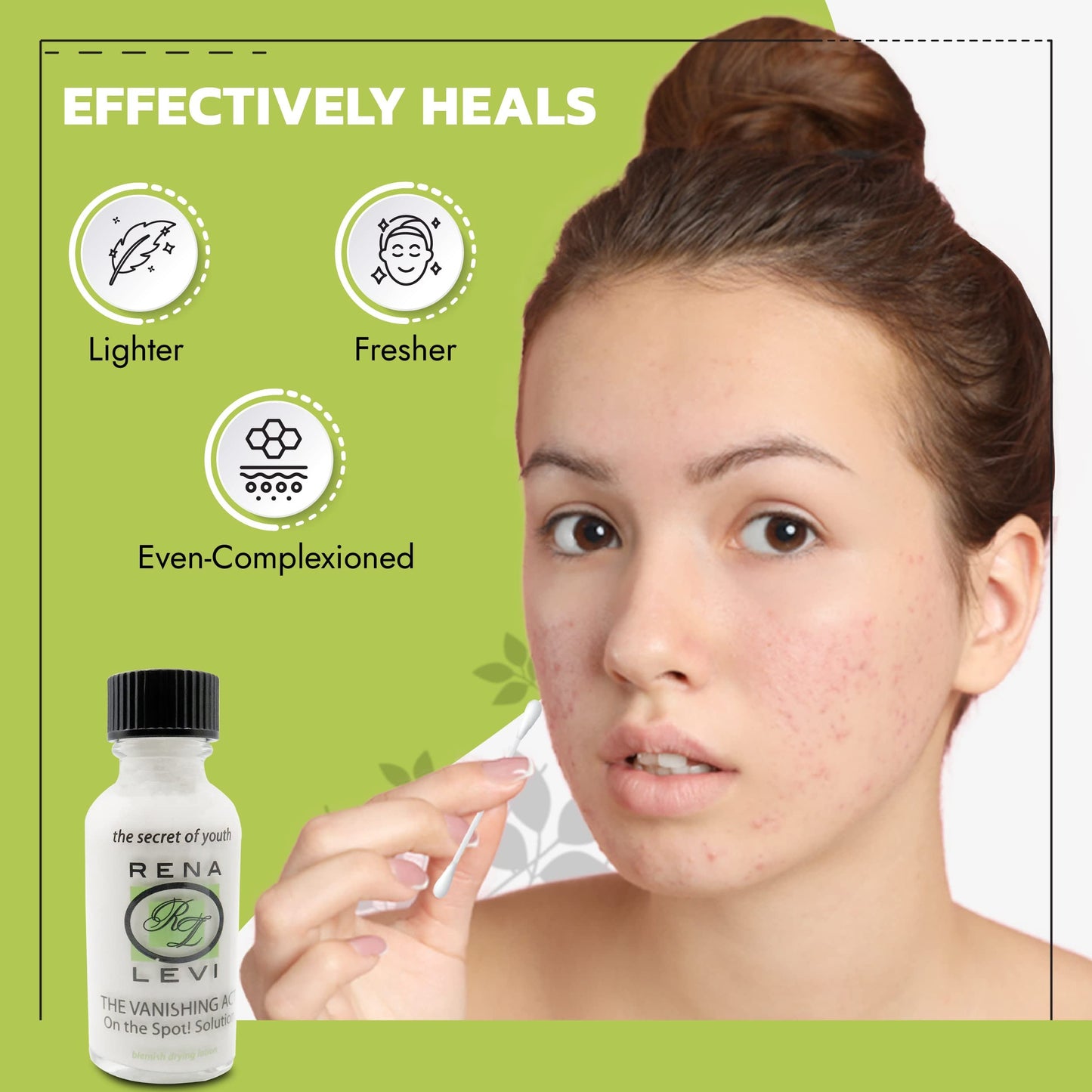 Rena Levi Acne Spot Treatment - One The Spot Acne Treatment For Face - Body Acne Treatment For Women - Acne Lotion For Face And Body - Dries Out Blemishes And Pores - Back Acne Treatment - 1oz